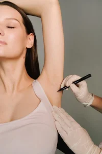 بوتاکس زیر بغل