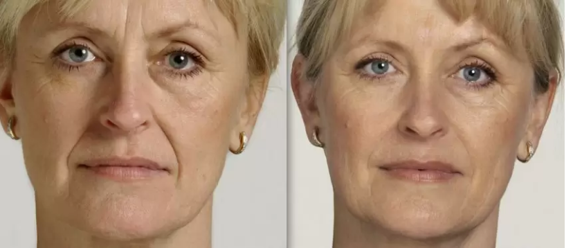 راهکار جوانسازی