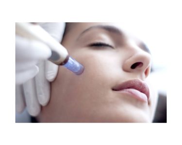 مزو نیدلینگ